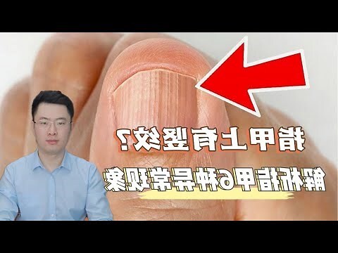 指甲 直紋